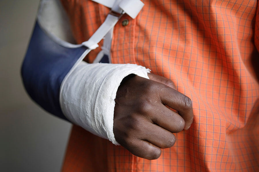 A close-up of a person's arm in a cast